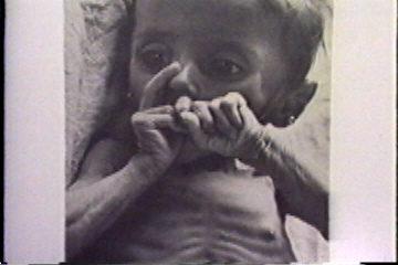A starving child.